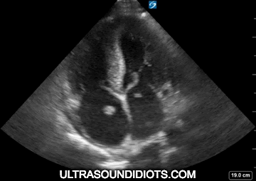 NARI PURELY SONIC NARL ULTRA SOUND クリアランス特価 inspektorat
